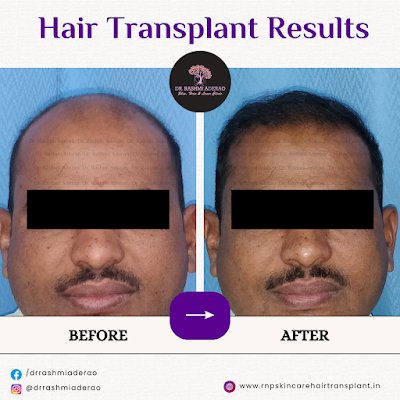 Dr. Rashmi Sarkar Dermatology Clinic