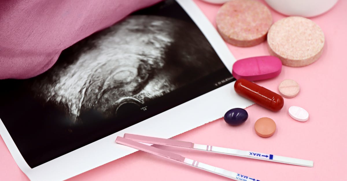 Leading IVF Clinics in Chennai